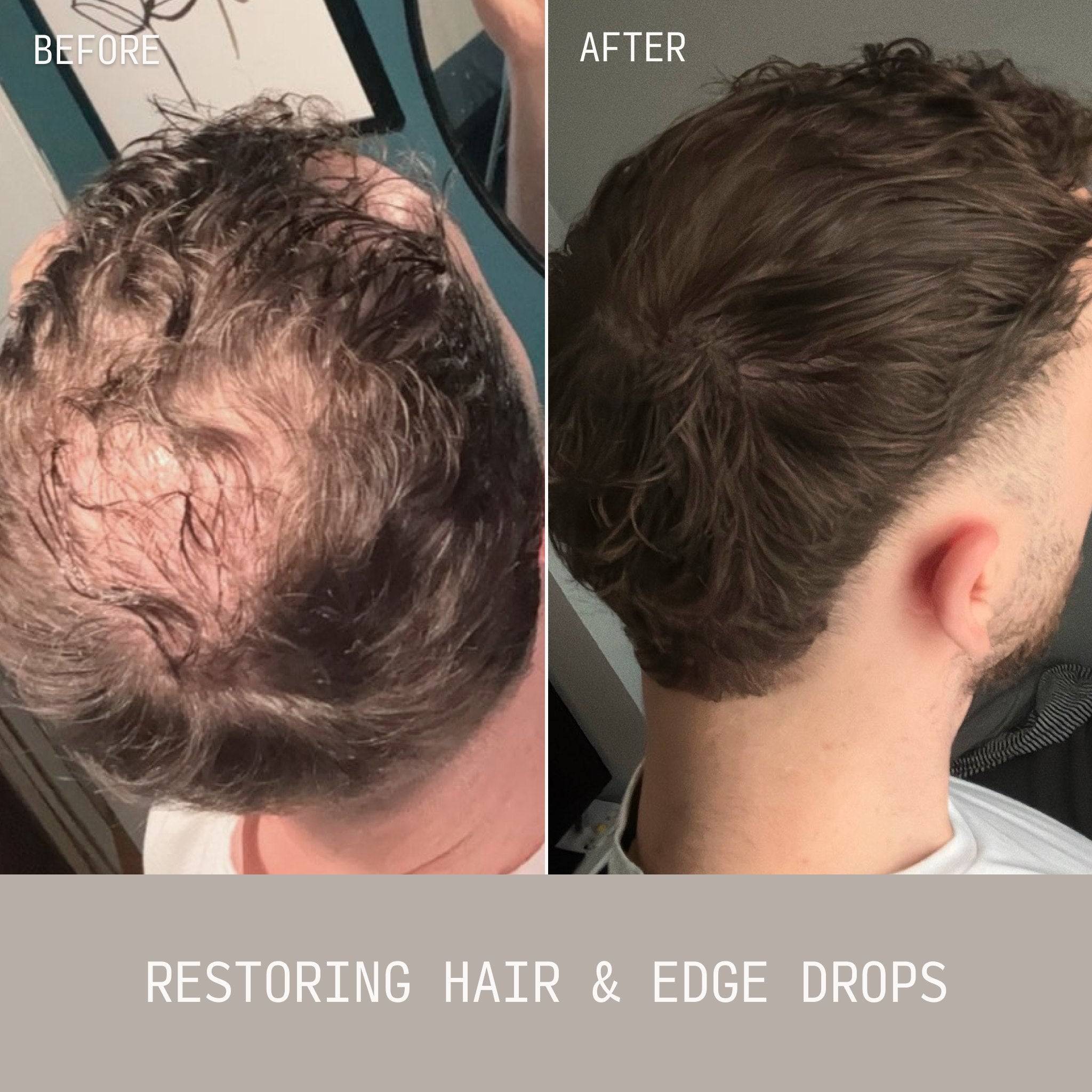 Hair Density Serum - Edge Drops | Cécred